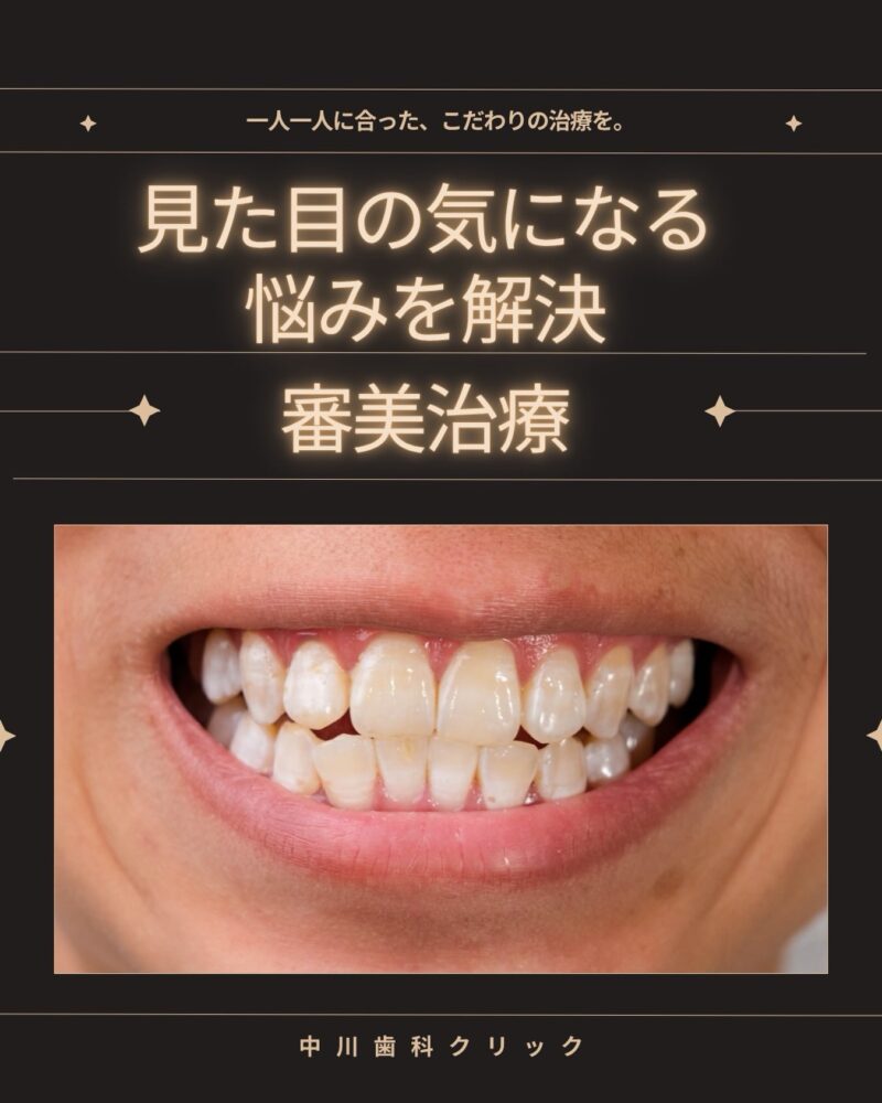 🦷 口元の印象、気になっ…