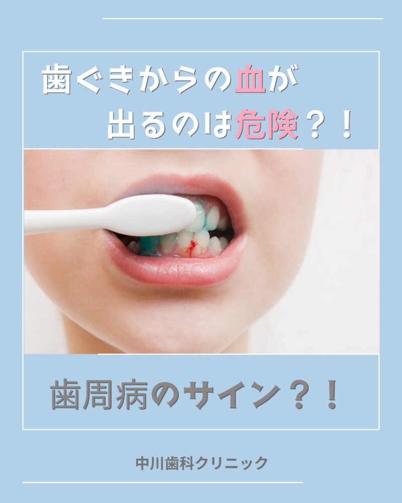 Q、「歯ぐきから血が出る…